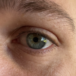 iridology