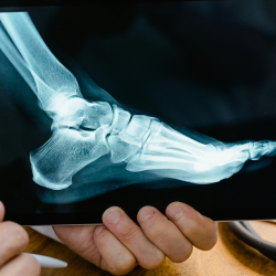 Musculoskeletal Injuries Musculoskeletal Injuries